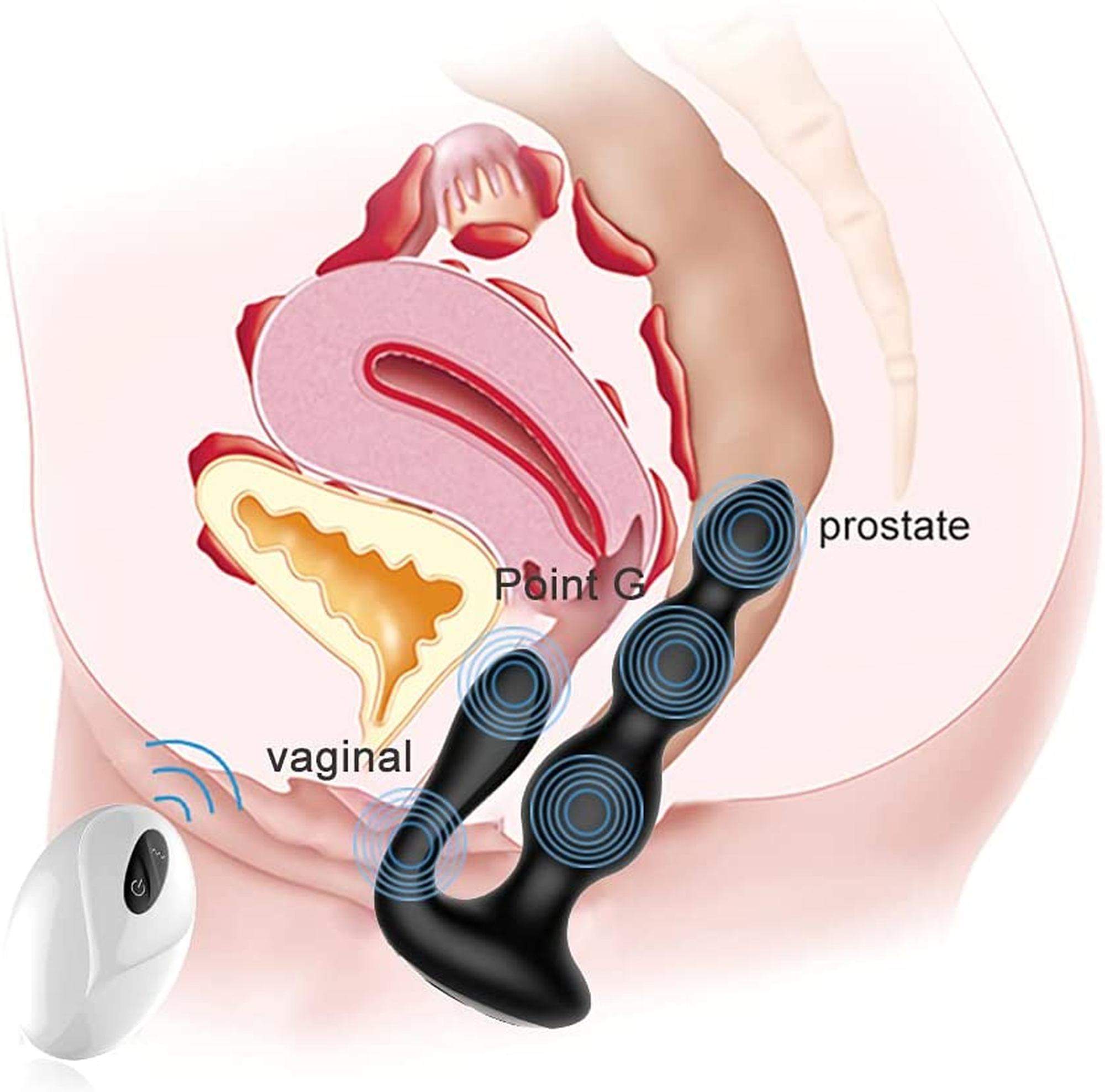 Silikonowe kulki analne- zdalnie sterowane do stymulacji punkt P (prostaty) oraz punktu G u kobiety 2w1